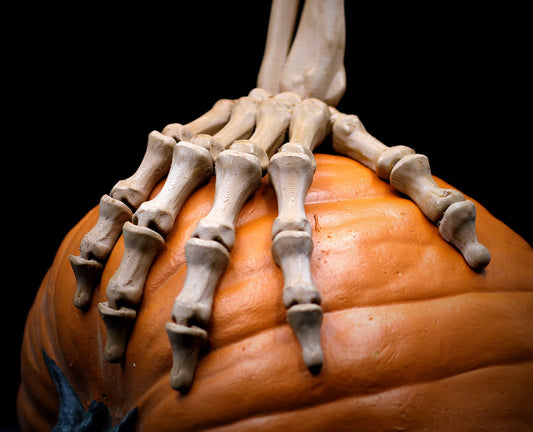 Skele-hands, Flexi-fingered hand and arm